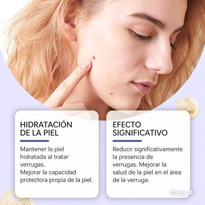 Removedor de manchas